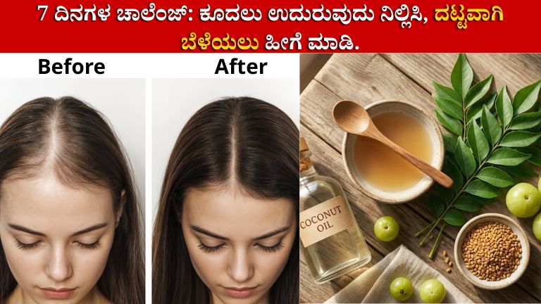 ಕೂದಲು ಬೆಳೆಯಲು ಮನೆಮದ್ದುಗಳು