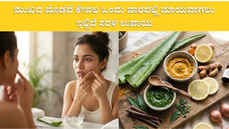 ಮೊಡವೆಗಳು ಹೋಗಲು ಮನೆಮದ್ದು