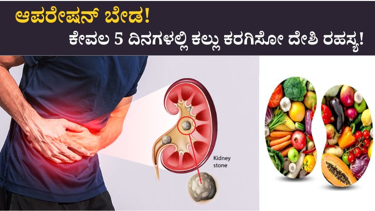 Kidney stone